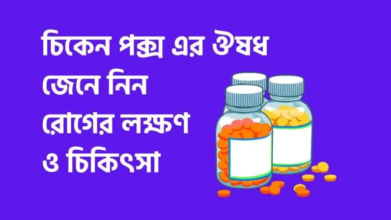চিকেন পক্স এর ঔষধ